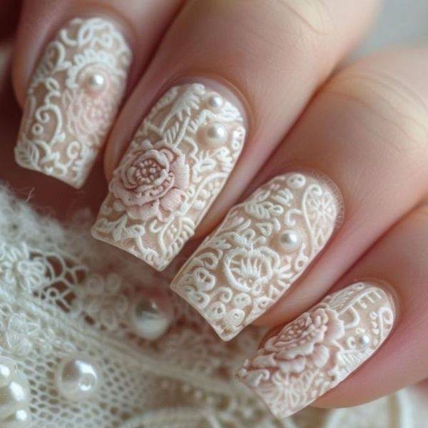 Lace Overlay